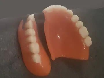 Compostura simple de prótesis dental en A Coruña
