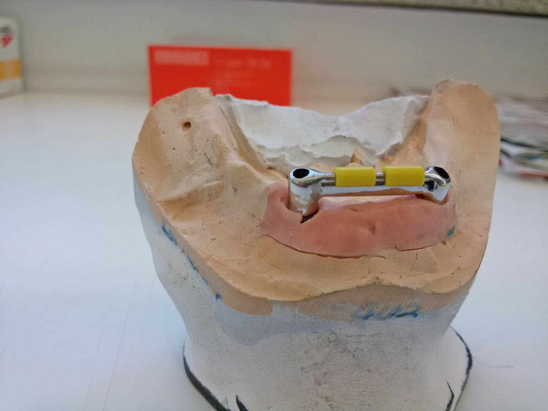 Laboratorio dental en A Coruña