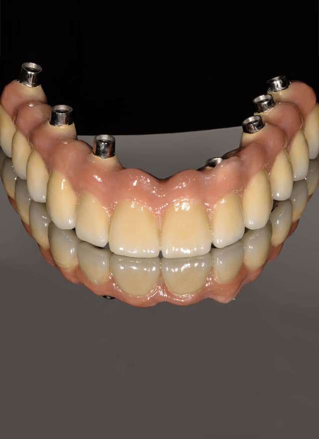 Laboratorio Dental Darriba, nuestros campos de
                                        trabajo