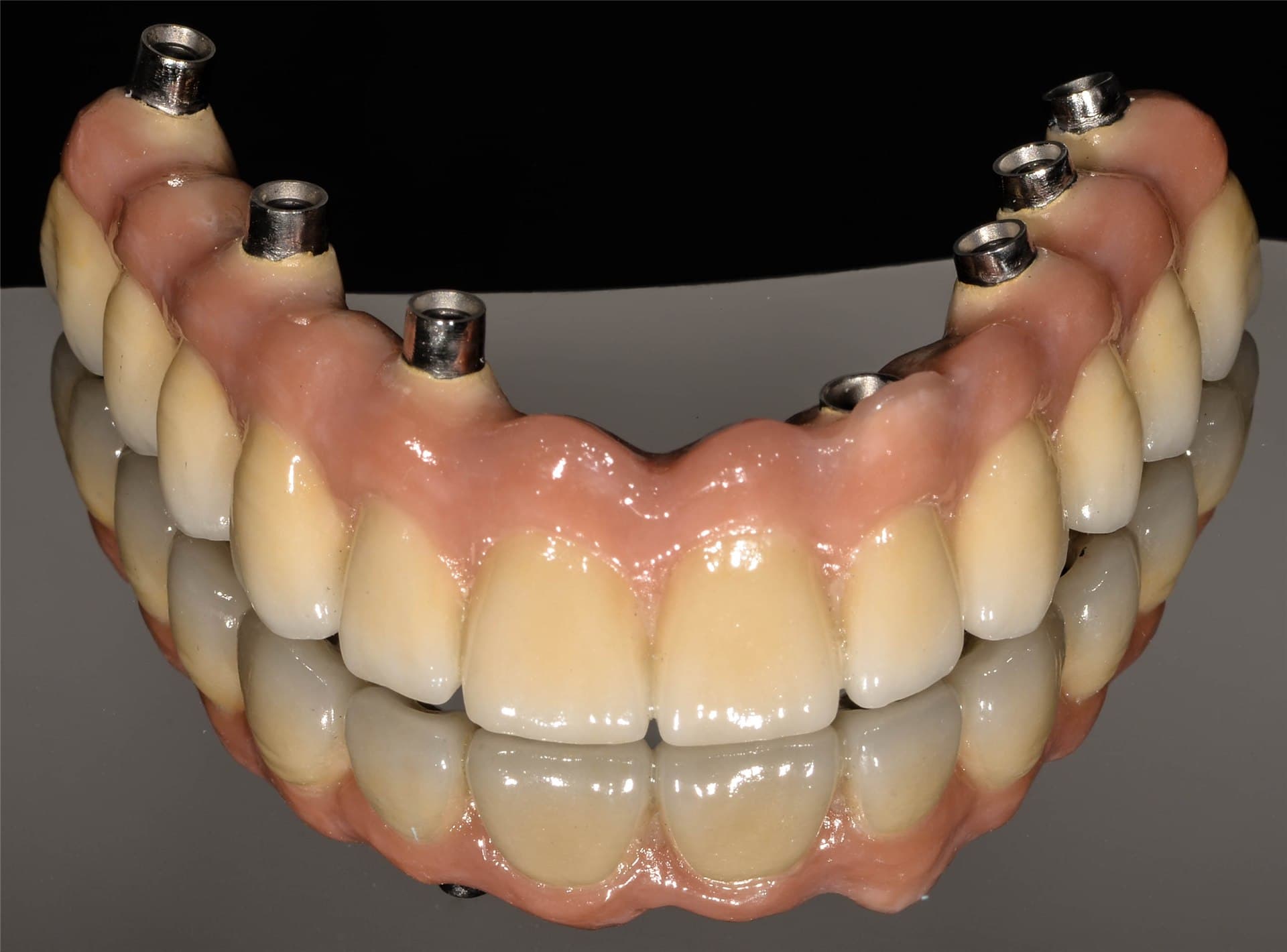 Trabajos de Laboratorio Dental Darriba