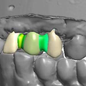 Laboratorio Dental Darriba