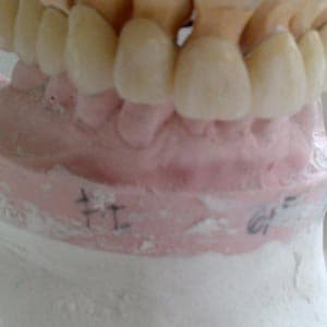 Laboratorio Dental Darriba